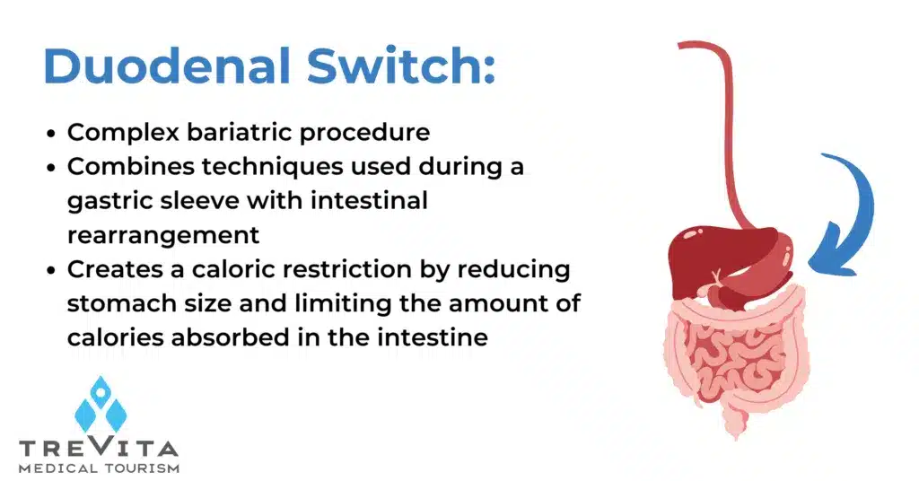 The Duodenal Switch 