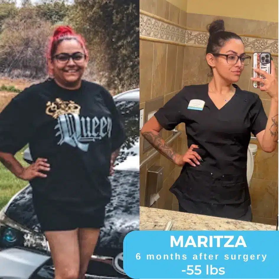 maritza-before-and-after-bariatric-surgery.png