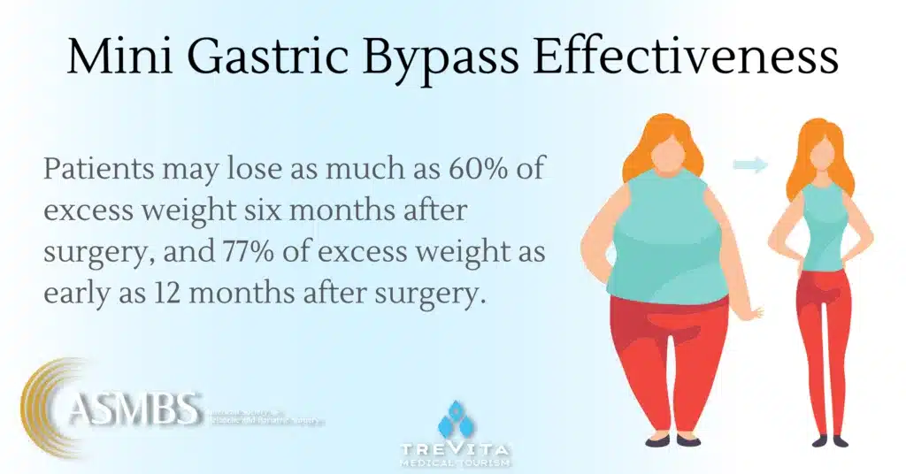 Mini Gastric Bypass